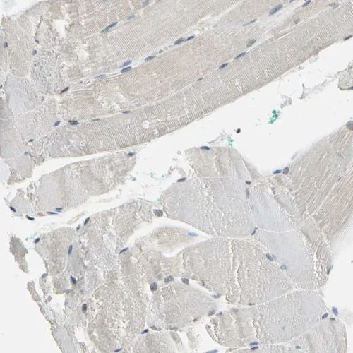 Immunohistochemistry (Formalin/PFA-fixed paraffin-embedded sections) - Anti-NFAT1 antibody (AB244310)