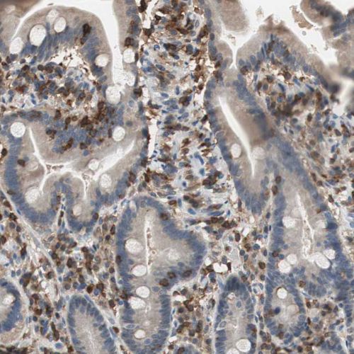 Immunohistochemistry (Formalin/PFA-fixed paraffin-embedded sections) - Anti-NFAT1 antibody (AB244310), expandable thumbnail