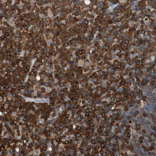 Immunohistochemistry (Formalin/PFA-fixed paraffin-embedded sections) - Anti-NFAT1 antibody (AB244310), expandable thumbnail