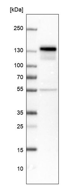 Western blot - Anti-NFAT1 antibody (AB244310), expandable thumbnail