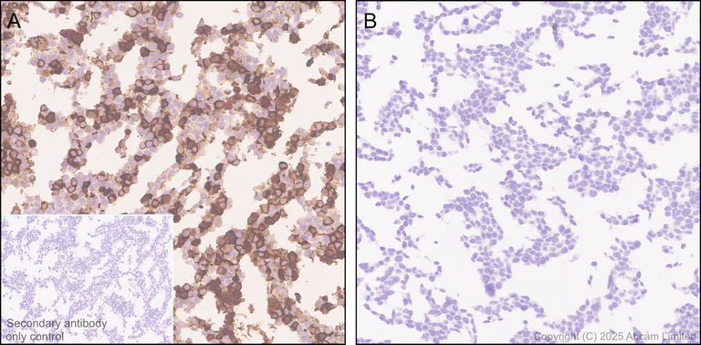 Immunohistochemistry (Formalin/PFA-fixed paraffin-embedded sections) - Anti-NFAT1 antibody [EPR30445-509] (AB325917)