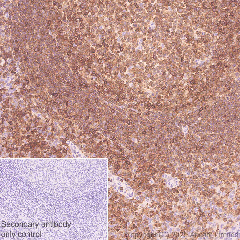 Immunohistochemistry (Formalin/PFA-fixed paraffin-embedded sections) - Anti-NFAT1 antibody [EPR30445-509] (AB325917)