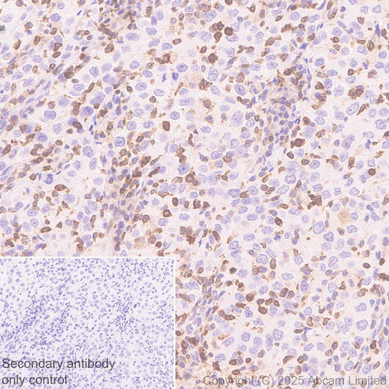 Immunohistochemistry (Formalin/PFA-fixed paraffin-embedded sections) - Anti-NFAT1 antibody [EPR30445-509] (AB325917)