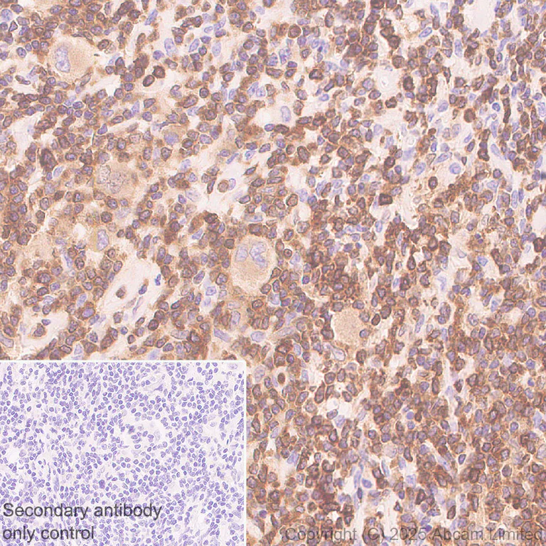 Immunohistochemistry (Formalin/PFA-fixed paraffin-embedded sections) - Anti-NFAT1 antibody [EPR30445-509] (AB325917)