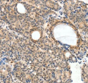 Immunohistochemistry (Formalin/PFA-fixed paraffin-embedded sections) - Anti-NFAT1 antibody - N-terminal (AB198748)