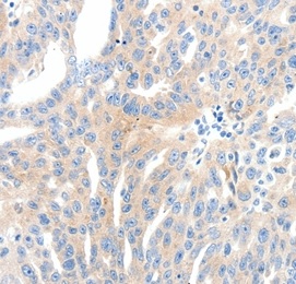 Immunohistochemistry (Formalin/PFA-fixed paraffin-embedded sections) - Anti-NFAT1 antibody - N-terminal (AB198748)