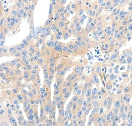 Immunohistochemistry (Formalin/PFA-fixed paraffin-embedded sections) - Anti-NFAT1 antibody - N-terminal (AB198748)