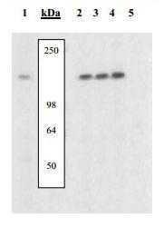 Western blot - Anti-NFAT1 (phospho S54) antibody (AB200819)