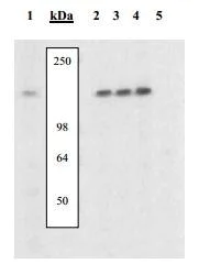 Western blot - Anti-NFAT1 (phospho S54) antibody (AB200819)