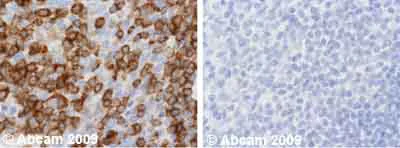 Immunohistochemistry (Formalin/PFA-fixed paraffin-embedded sections) - Anti-NFAT2 antibody [7A6] (AB2796)