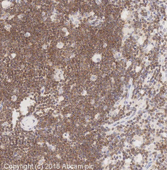 Immunohistochemistry (Formalin/PFA-fixed paraffin-embedded sections) - Anti-NFAT2 antibody [7A6] (AB2796)