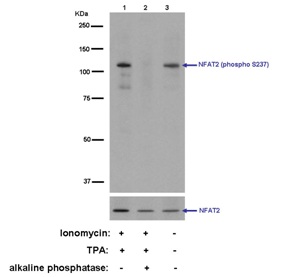 Anti-NFAT2 (phospho S237) antibody [EPR2377(N)]