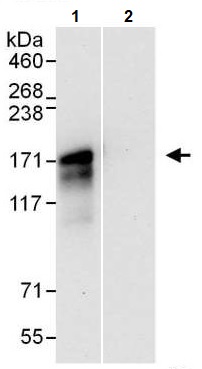 Immunoprecipitation - Anti-NFAT4/NF-ATc3 antibody (AB245501)