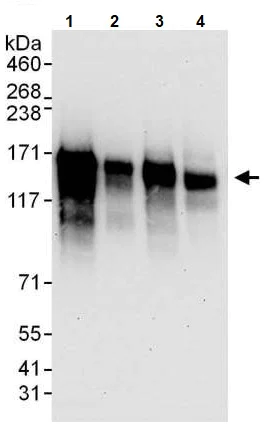 Western blot - Anti-NFAT4/NF-ATc3 antibody (AB245501)