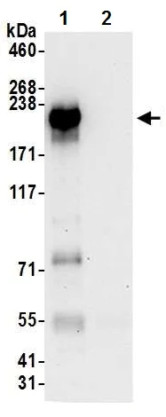 Immunoprecipitation - Anti-NFAT5 antibody (AB226308)