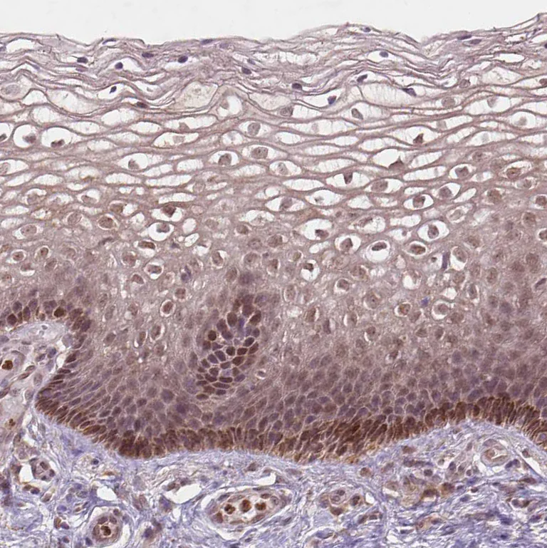 Immunohistochemistry (Formalin/PFA-fixed paraffin-embedded sections) - Anti-NFAT5 Antibody (AB327272)