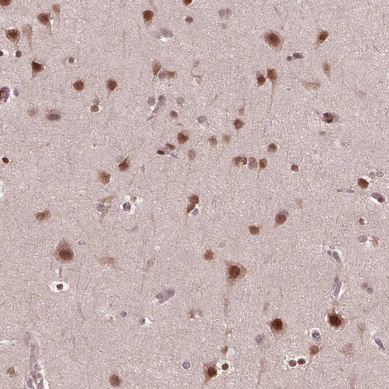 Immunohistochemistry (Formalin/PFA-fixed paraffin-embedded sections) - Anti-NFAT5 Antibody (AB327272)