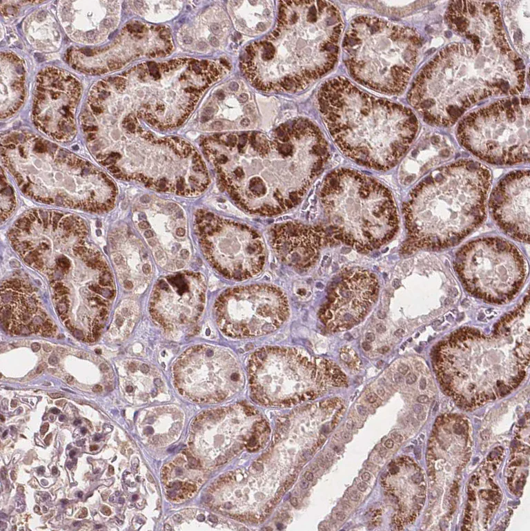 Immunohistochemistry (Formalin/PFA-fixed paraffin-embedded sections) - Anti-NFAT5 Antibody (AB327272)