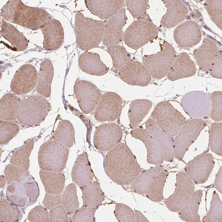 Immunohistochemistry (Formalin/PFA-fixed paraffin-embedded sections) - Anti-NFAT5 Antibody (AB327272)