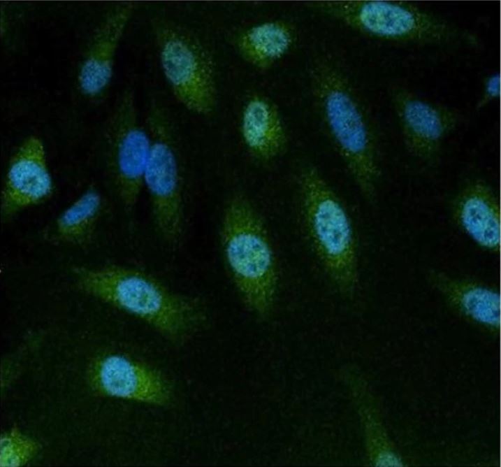 Immunocytochemistry/ Immunofluorescence - Anti-NFAT5 antibody (ab3446), expandable thumbnail