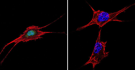 Immunocytochemistry/ Immunofluorescence - Anti-NFAT5 antibody (AB3446), expandable thumbnail