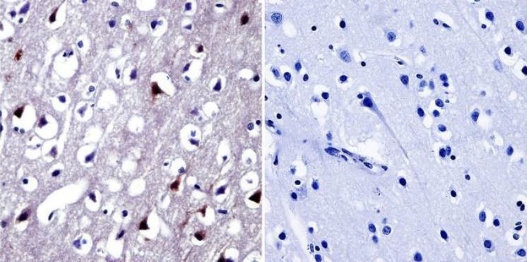 Immunohistochemistry (Formalin/PFA-fixed paraffin-embedded sections) - Anti-NFAT5 antibody (ab3446), expandable thumbnail