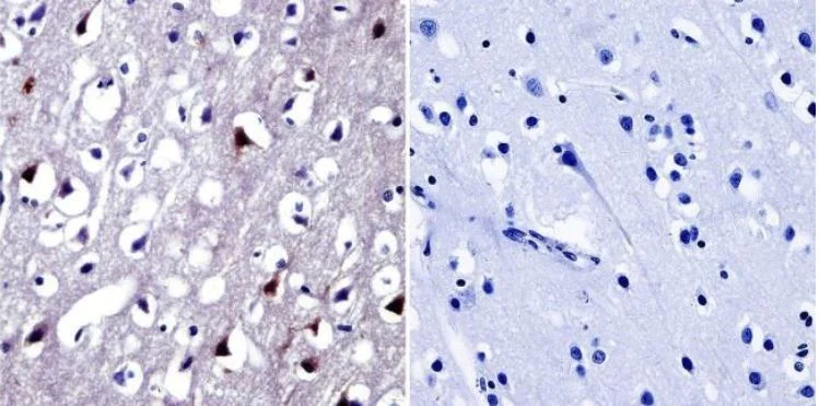 Immunohistochemistry (Formalin/PFA-fixed paraffin-embedded sections) - Anti-NFAT5 antibody (AB3446)
