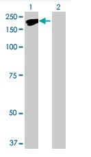 Western blot - NFAT5 overexpression 293T lysate (whole cell) (AB94270)