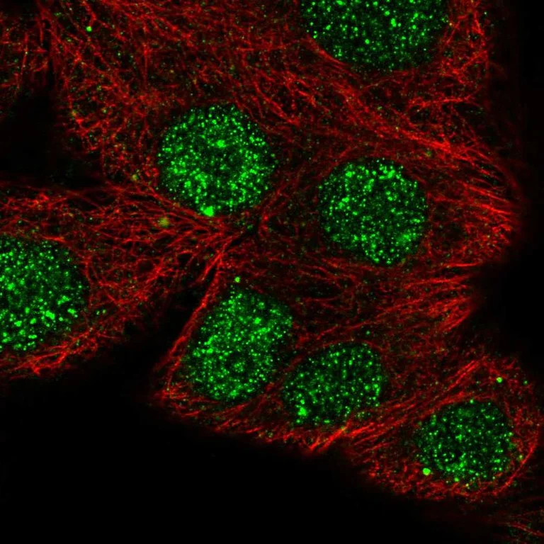 Immunocytochemistry/ Immunofluorescence - Anti-NFATC1 Antibody (AB327276)