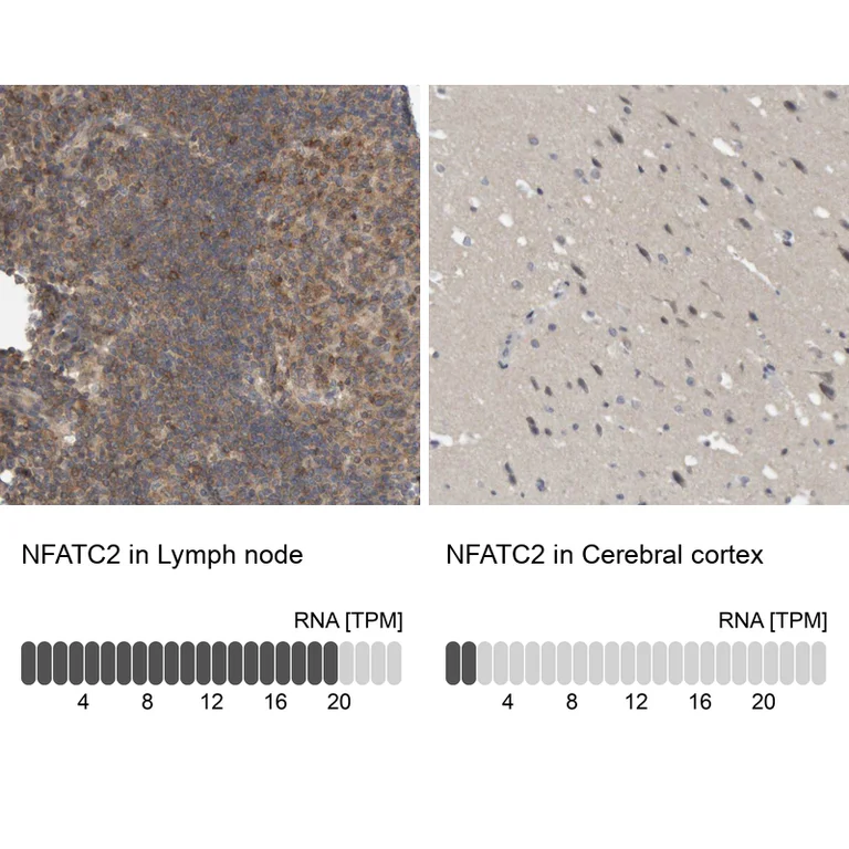 Immunohistochemistry (Formalin/PFA-fixed paraffin-embedded sections) - Anti-NFATC2 Antibody (AB327205)