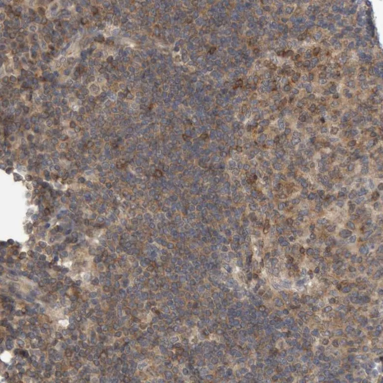 Immunohistochemistry (Formalin/PFA-fixed paraffin-embedded sections) - Anti-NFATC2 Antibody (AB327205)