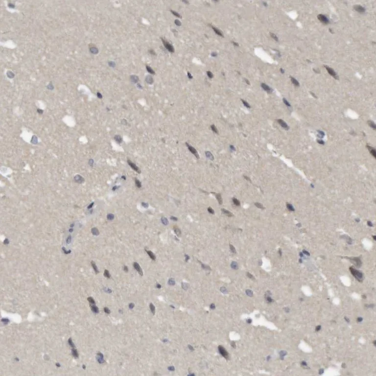 Immunohistochemistry (Formalin/PFA-fixed paraffin-embedded sections) - Anti-NFATC2 Antibody (AB327205)