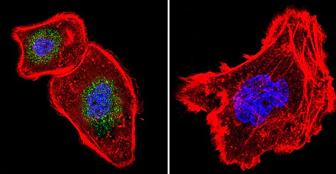 Immunocytochemistry/ Immunofluorescence - Anti-NFATC4 antibody (AB3447)