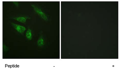 Immunocytochemistry/ Immunofluorescence - Anti-NFATC4 antibody (AB62613)