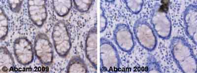 Immunohistochemistry (Formalin/PFA-fixed paraffin-embedded sections) - Anti-NFATC4 antibody (AB62613)