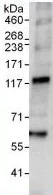 Immunoprecipitation - Anti-NFATC4 antibody (AB99431)