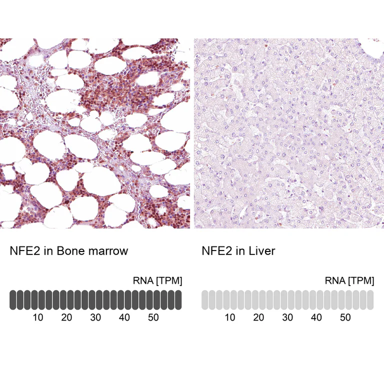 Immunohistochemistry (Formalin/PFA-fixed paraffin-embedded sections) - Anti-NFE2 Antibody (AB327173)