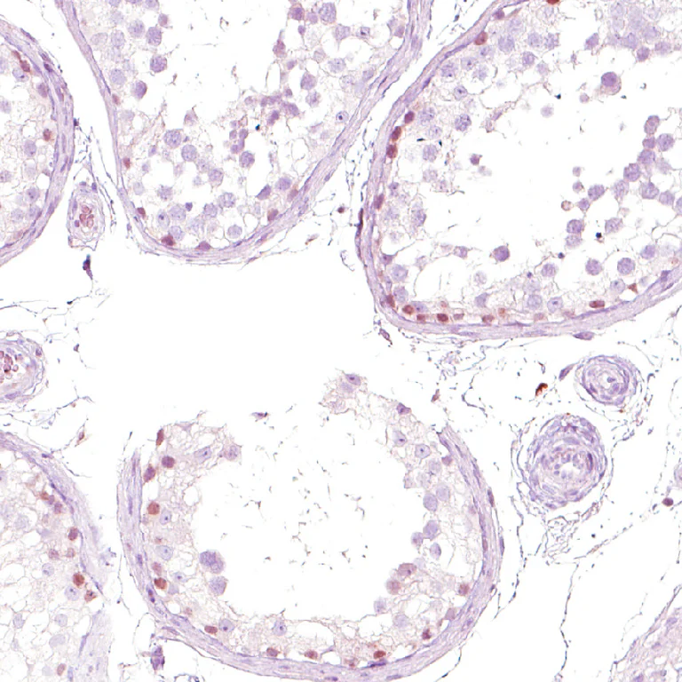 Immunohistochemistry (Formalin/PFA-fixed paraffin-embedded sections) - Anti-NFE2 Antibody (AB327173)