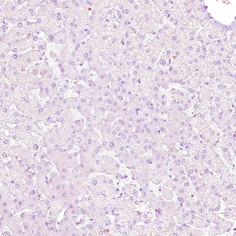 Immunohistochemistry (Formalin/PFA-fixed paraffin-embedded sections) - Anti-NFE2 Antibody (AB327173)