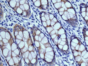Immunohistochemistry (Formalin/PFA-fixed paraffin-embedded sections) - Anti-NFE2 antibody [EPR2824(2)] (AB140598)