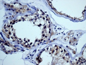 Immunohistochemistry (Formalin/PFA-fixed paraffin-embedded sections) - Anti-NFE2 antibody [EPR2824(2)] (AB140598), expandable thumbnail