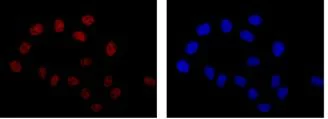 Immunocytochemistry/ Immunofluorescence - Anti-NFIB / NF1B2 antibody [EPR14122] (AB186738)