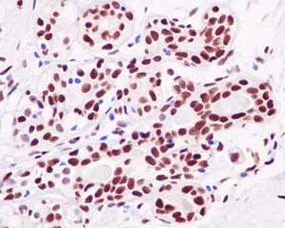 Immunohistochemistry (Formalin/PFA-fixed paraffin-embedded sections) - Anti-NFIB / NF1B2 antibody [EPR14122] (AB186738)