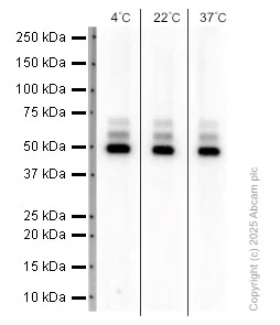 Western blot - Anti-NFIB / NF1B2 antibody [EPR14122] (AB186738)