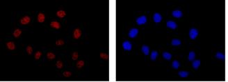 Immunocytochemistry/ Immunofluorescence - Anti-NFIB / NF1B2 antibody [EPR14122] - BSA and Azide free (ab250892), expandable thumbnail