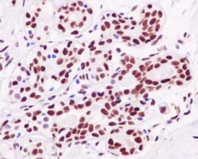 Immunohistochemistry (Formalin/PFA-fixed paraffin-embedded sections) - Anti-NFIB / NF1B2 antibody [EPR14122] - BSA and Azide free (AB250892), expandable thumbnail
