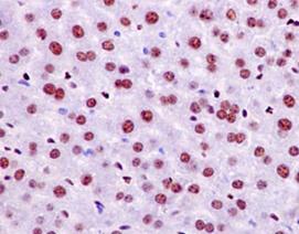 Immunohistochemistry (Formalin/PFA-fixed paraffin-embedded sections) - Anti-NFIB / NF1B2 antibody [EPR14122] - BSA and Azide free (ab250892), expandable thumbnail