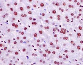 Immunohistochemistry (Formalin/PFA-fixed paraffin-embedded sections) - Anti-NFIB / NF1B2 antibody [EPR14122] - BSA and Azide free (AB250892)