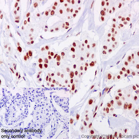 Immunohistochemistry (Formalin/PFA-fixed paraffin-embedded sections) - Anti-NFIB / NF1B2 + NFIC/CTF antibody [EPR14504] (ab200829), expandable thumbnail