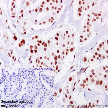 Immunohistochemistry (Formalin/PFA-fixed paraffin-embedded sections) - Anti-NFIB / NF1B2 + NFIC/CTF antibody [EPR14504] (AB200829)